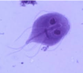 Giardiasis parasite symptoms. Giardia parasite symptoms humans