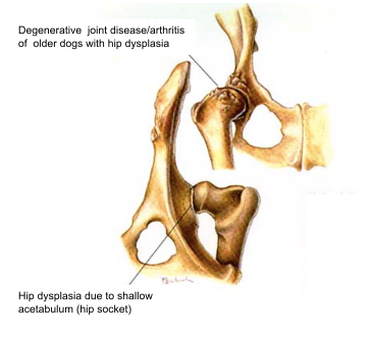 Hip Dysplasia