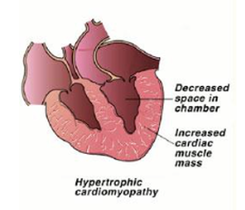 Hyperthyroidism in Cats