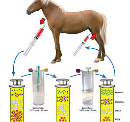 Pro-Stride: A Natural, Drug-Free Treatment for Joint Pain and Arthritis