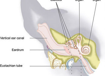 Vestibular Disease